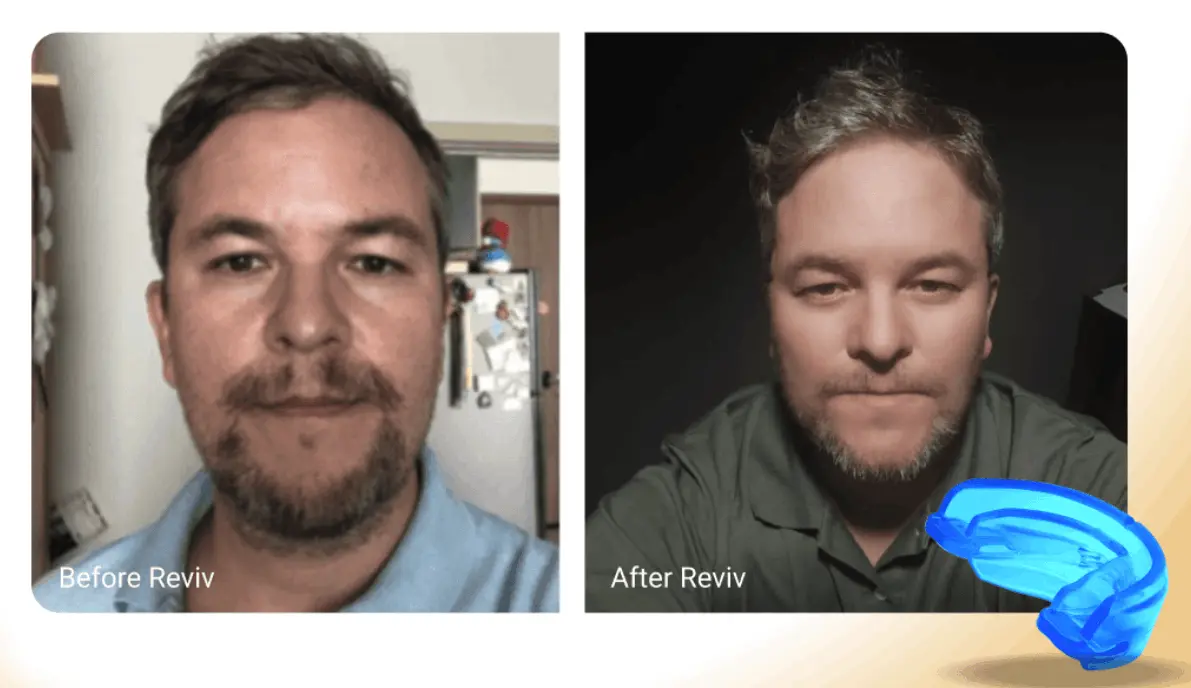 Reviv One Mouthguard review